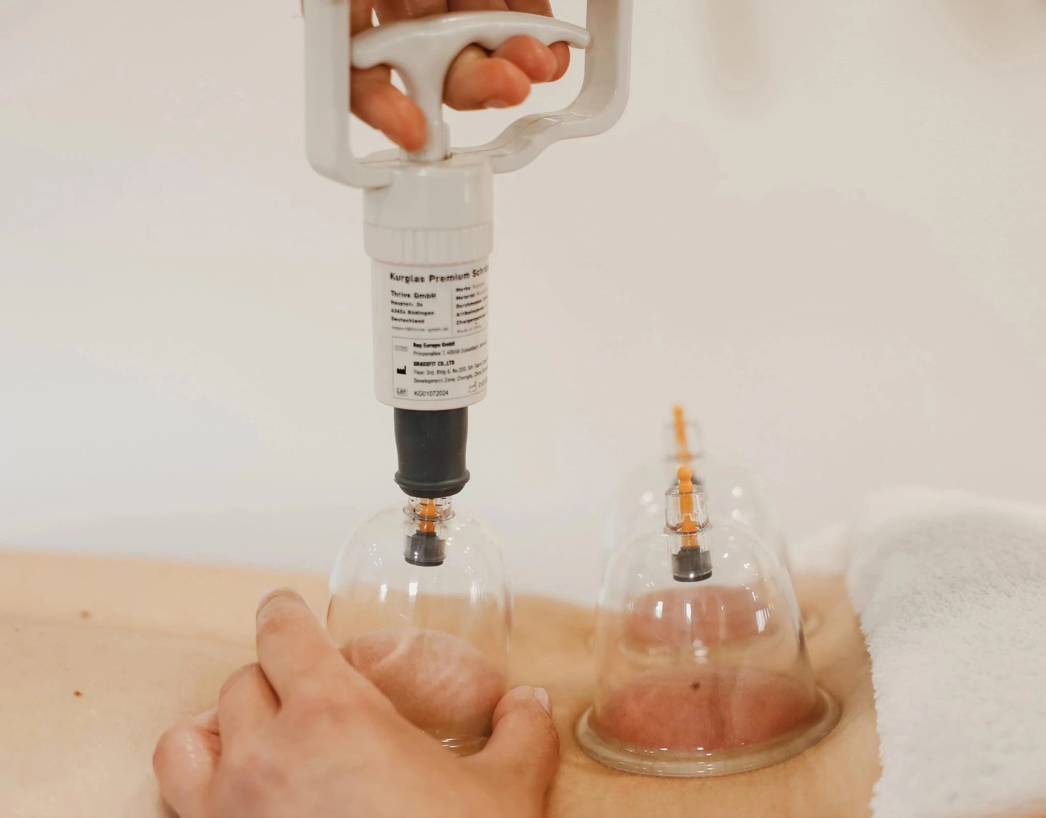Cupping