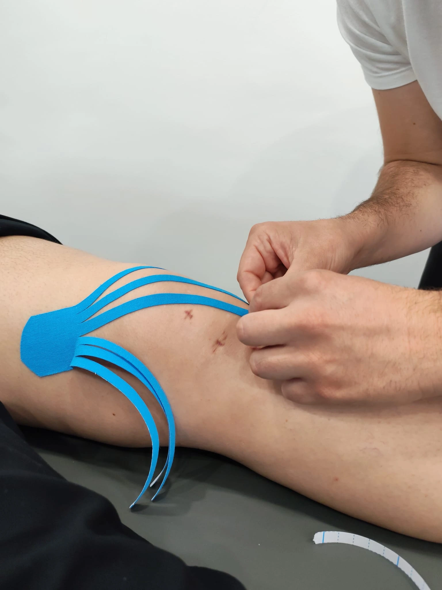 Kinesiotaping